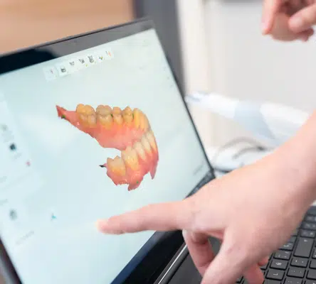 What is Smile Design