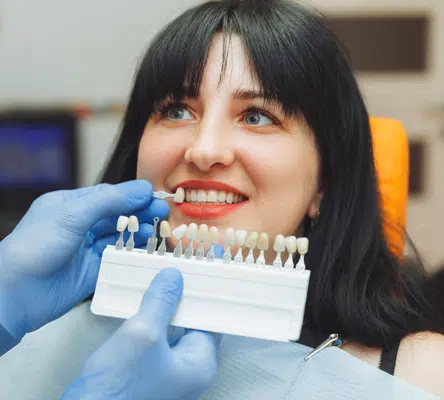 What Are Porcelain Veneers?