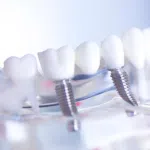 Dental Clinic Coquitlam