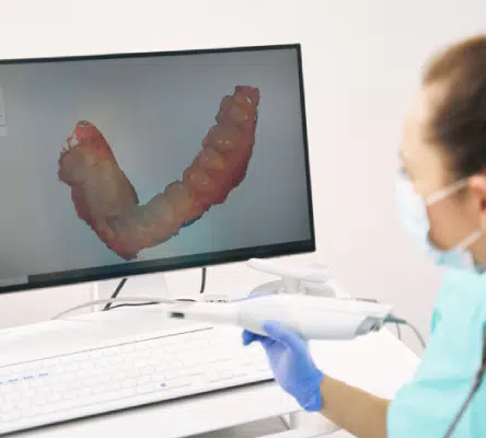 Introduction to CEREC Machines