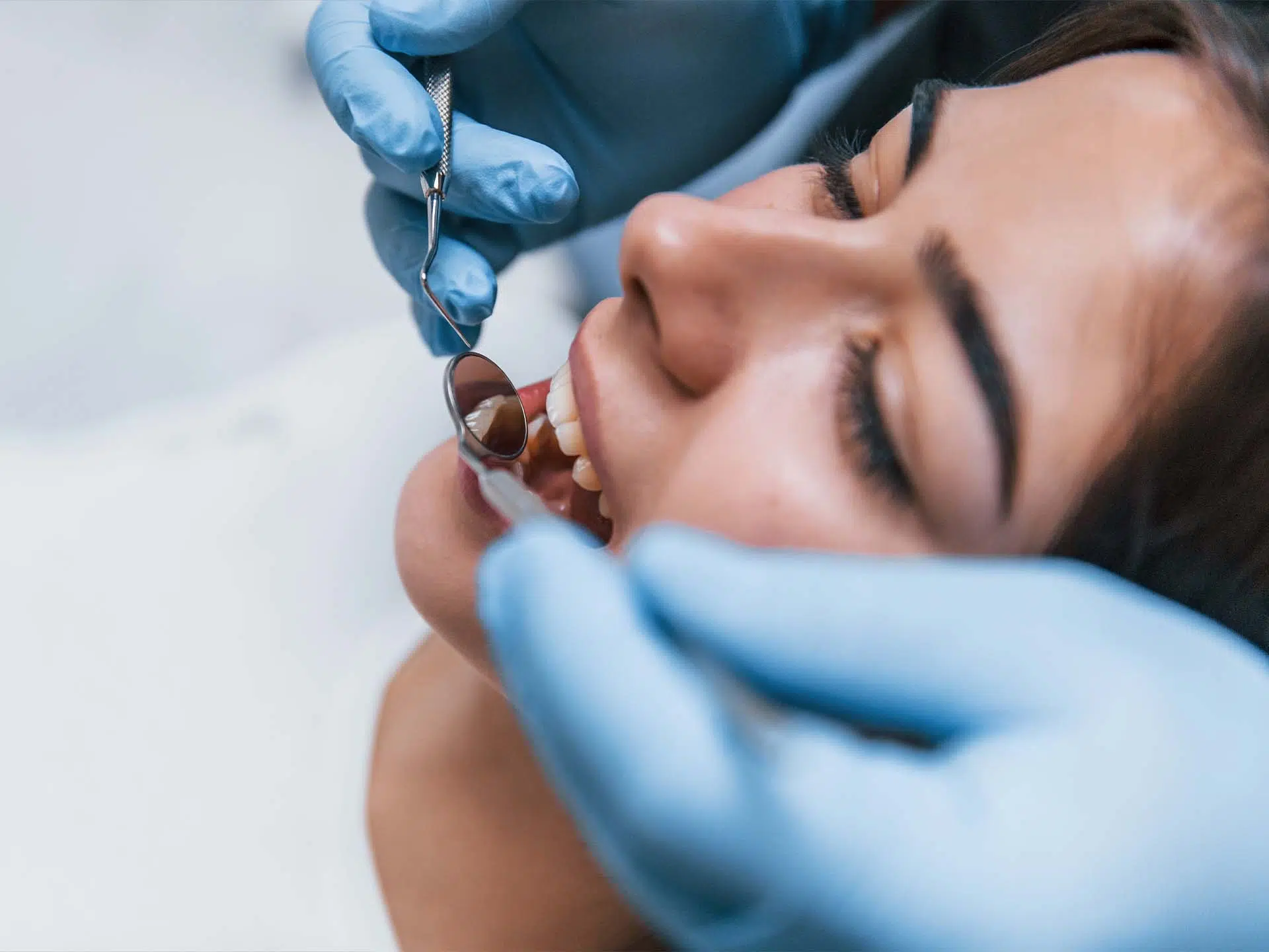 How Long Does Dental Bonding Last?