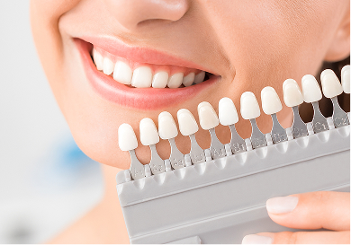 Porcelain Veneers